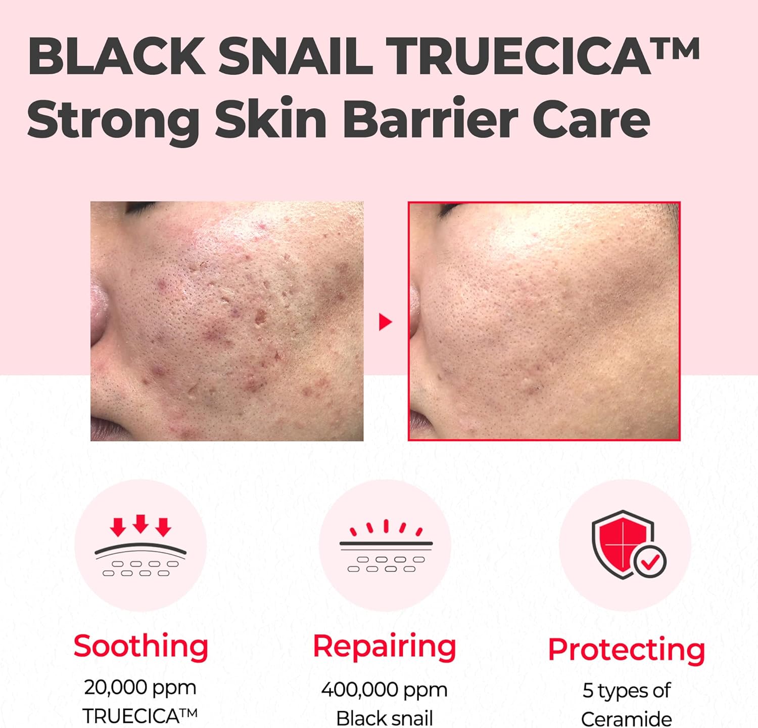 SOME BY MI Snail Truecica Miracle Repair Cream