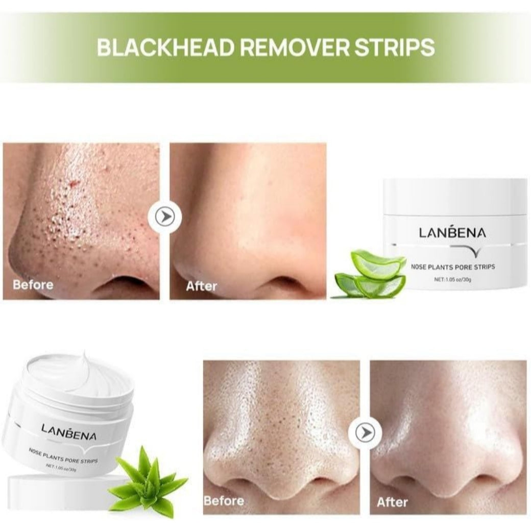 LANBENA Blackhead Remover Mask (1.05 Ounce)